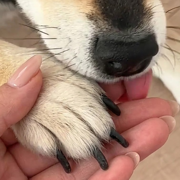 Long Nails Cause Daily Problems